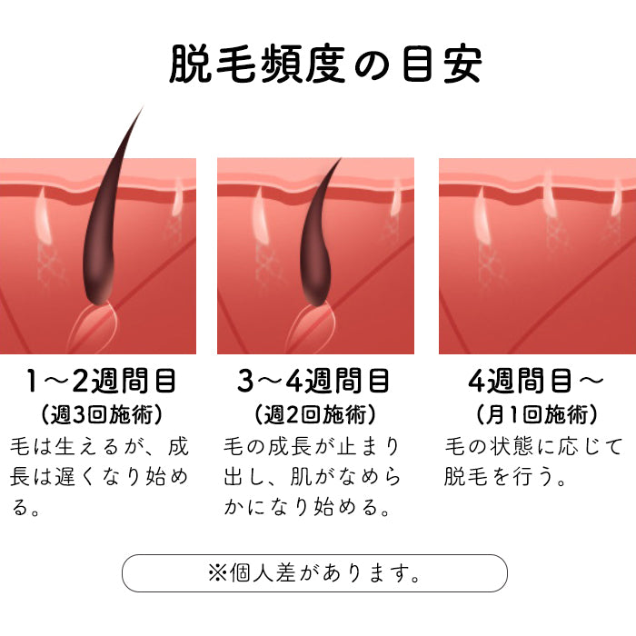 ［Folica］脱毛器